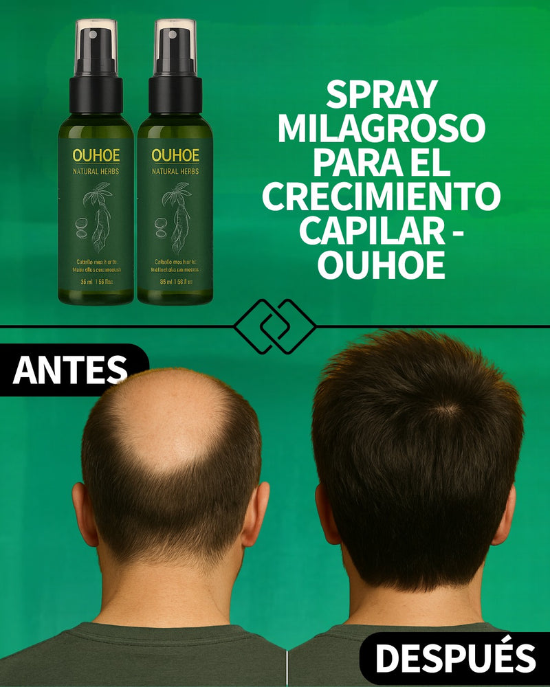 Nutri Ouhoe® - Para el crecimiento del cabello - (COMPRA 1 LLEVA 2)