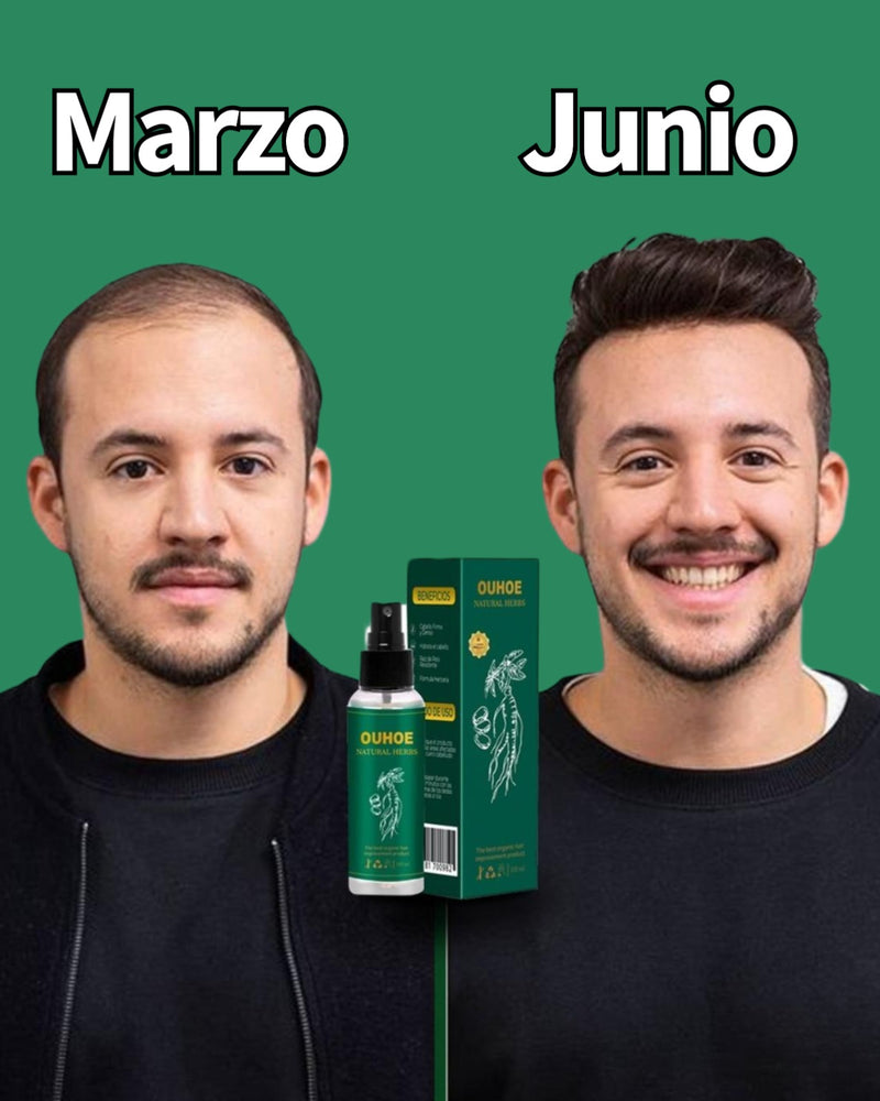 Nutri Ouhoe® - Para el crecimiento del cabello - (COMPRA 1 LLEVA 2)